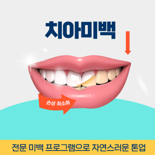 전주치과 전주시 치과 치아미백