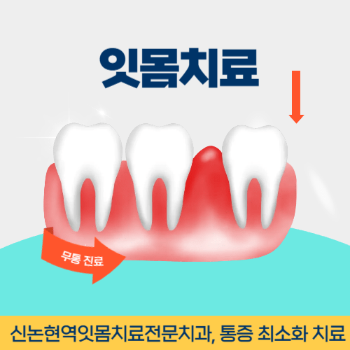전주치과 전주시 치과 잇몸치료